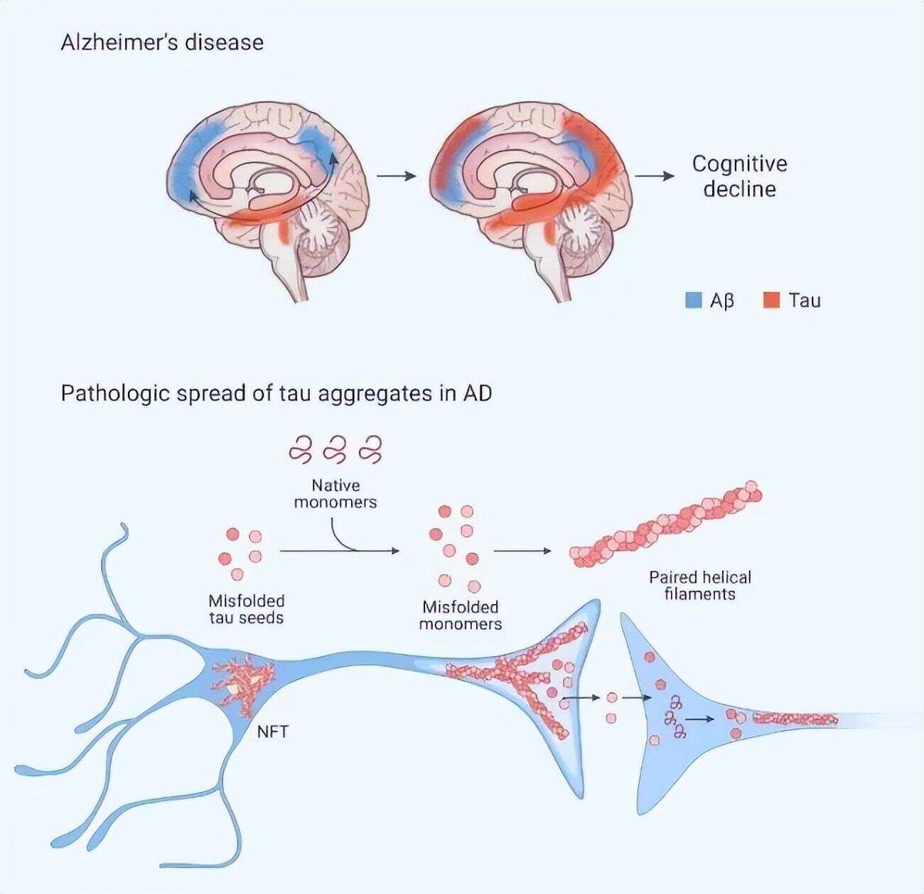 Surprising Brain Defenders: How Your Immune System’s CD8 T Cells Fight Tauopathy and Slow Dementia