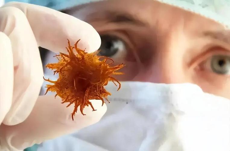 From Incurable to 90% Response: The Revolutionary Treatments Transforming Lymphoma Outcomes