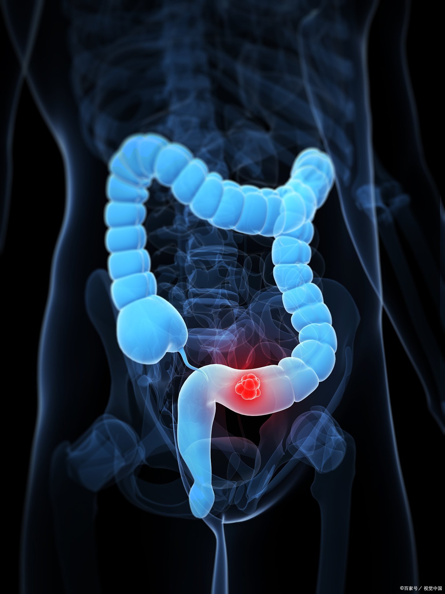 Shield Your Liver From Sugar Damage: How This Simple Fiber Reverses Fatty Liver (Backed by Science)